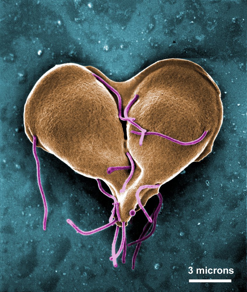 Cdc giardiasis treatment - Hotc paraziták A giardiasis életciklusa cdc