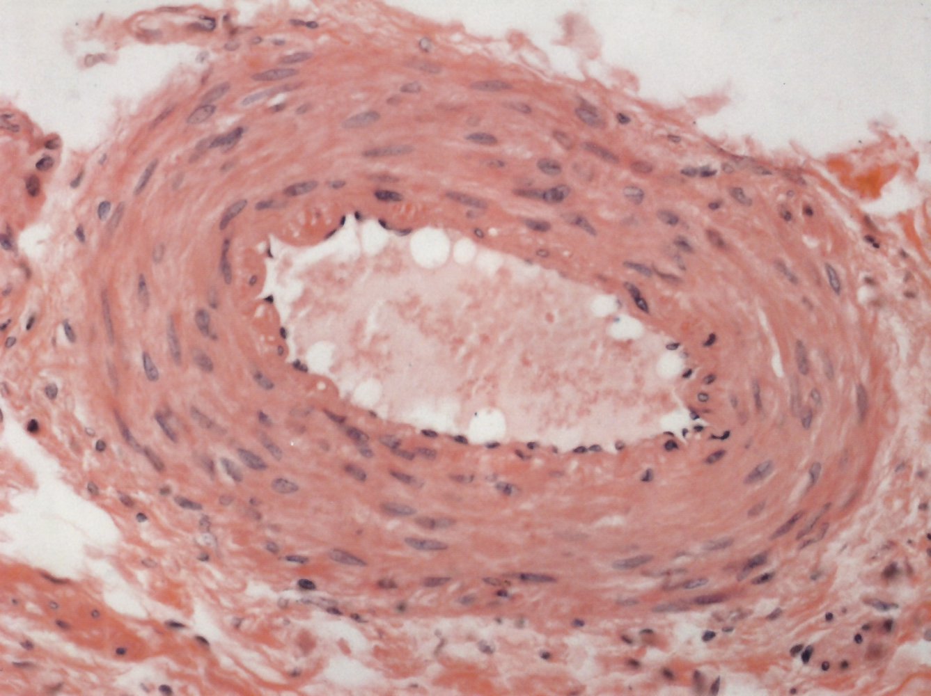 Blood Vessels Knowledge Amboss Blood Vessels Knowledge Amboss