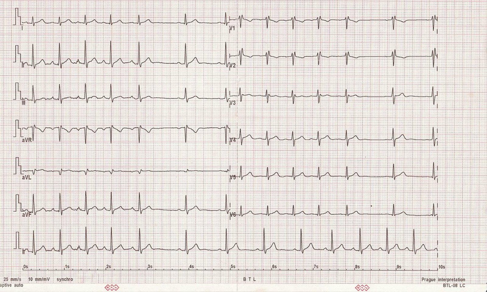 Overview Of Cardiac Arrhythmias Knowledge Amboss