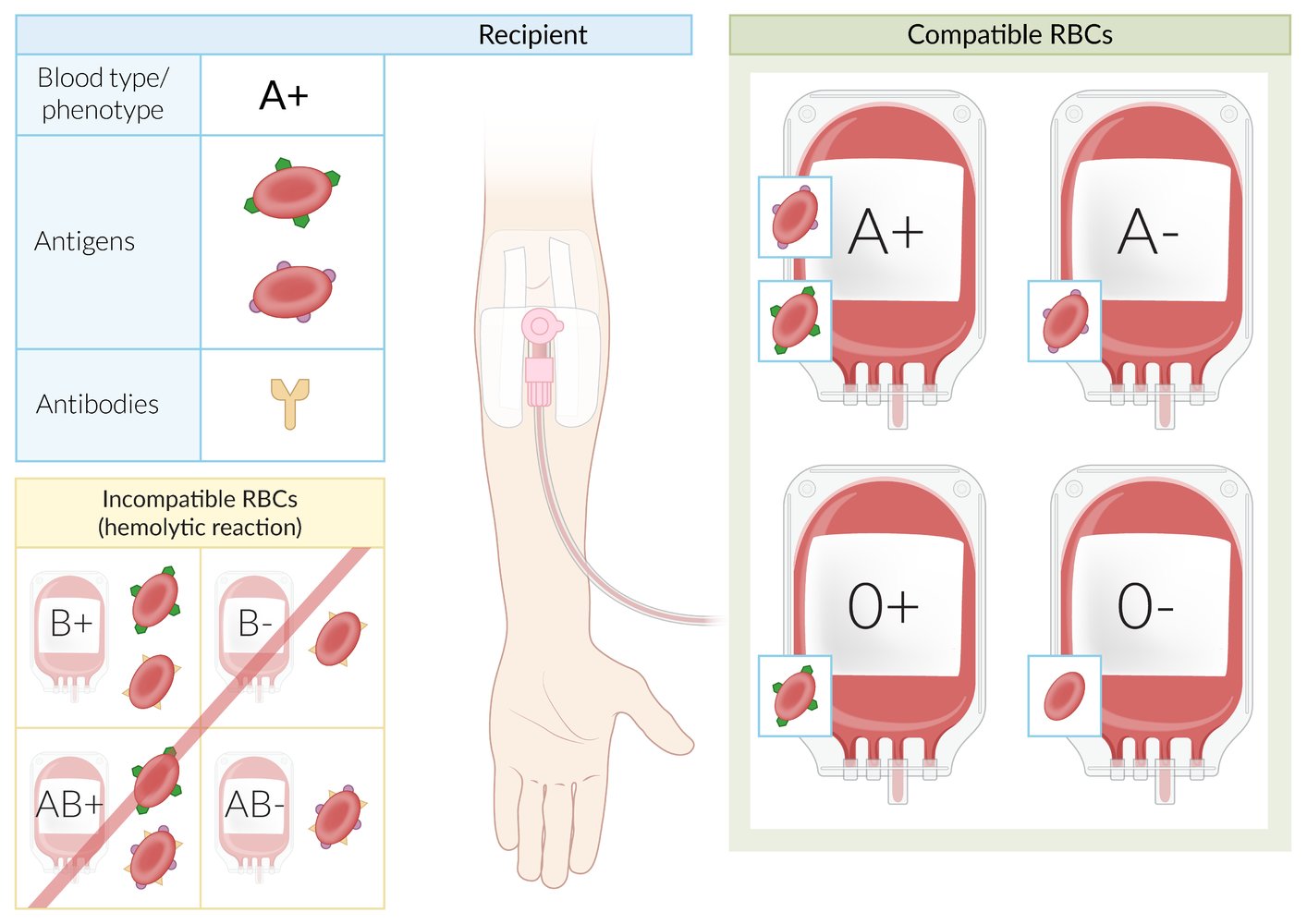 Transfusion Knowledge Amboss