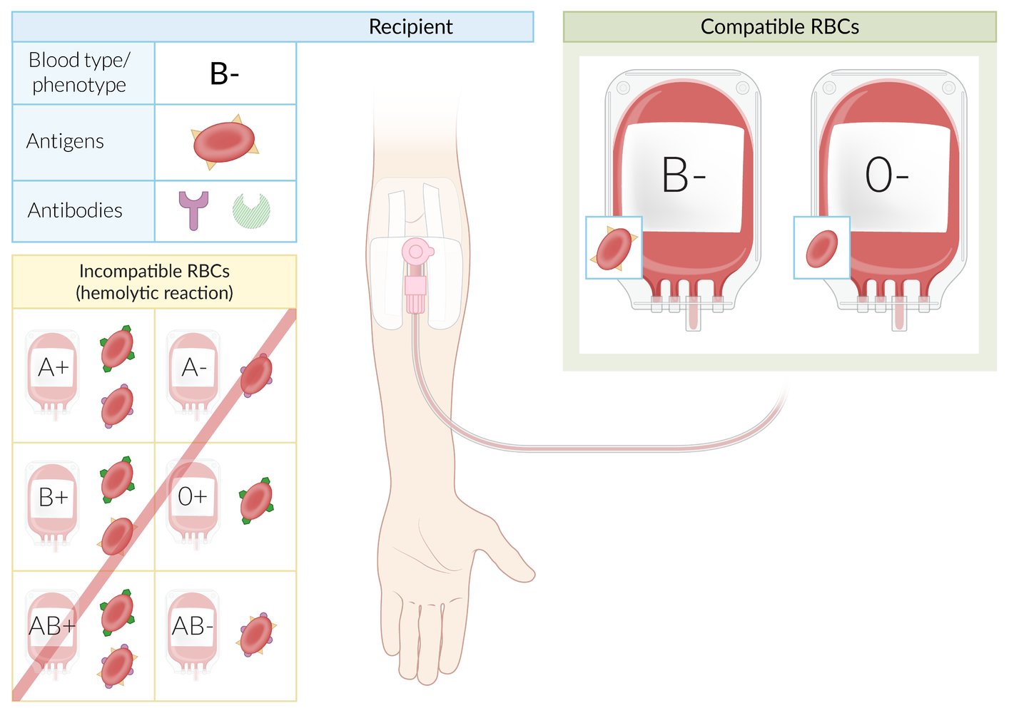Transfusion - Knowledge @ AMBOSS
