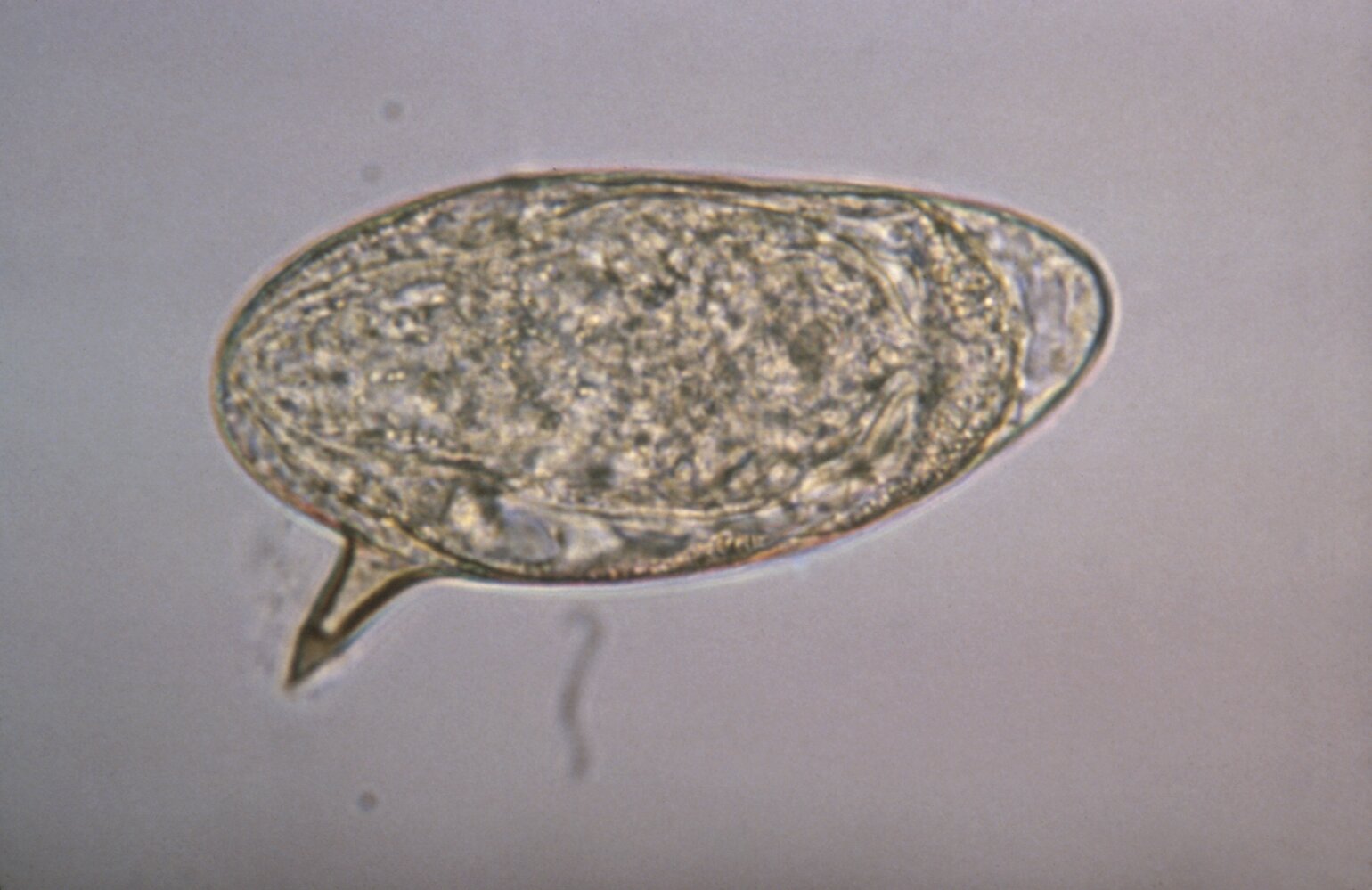 schistosoma haematobium rash