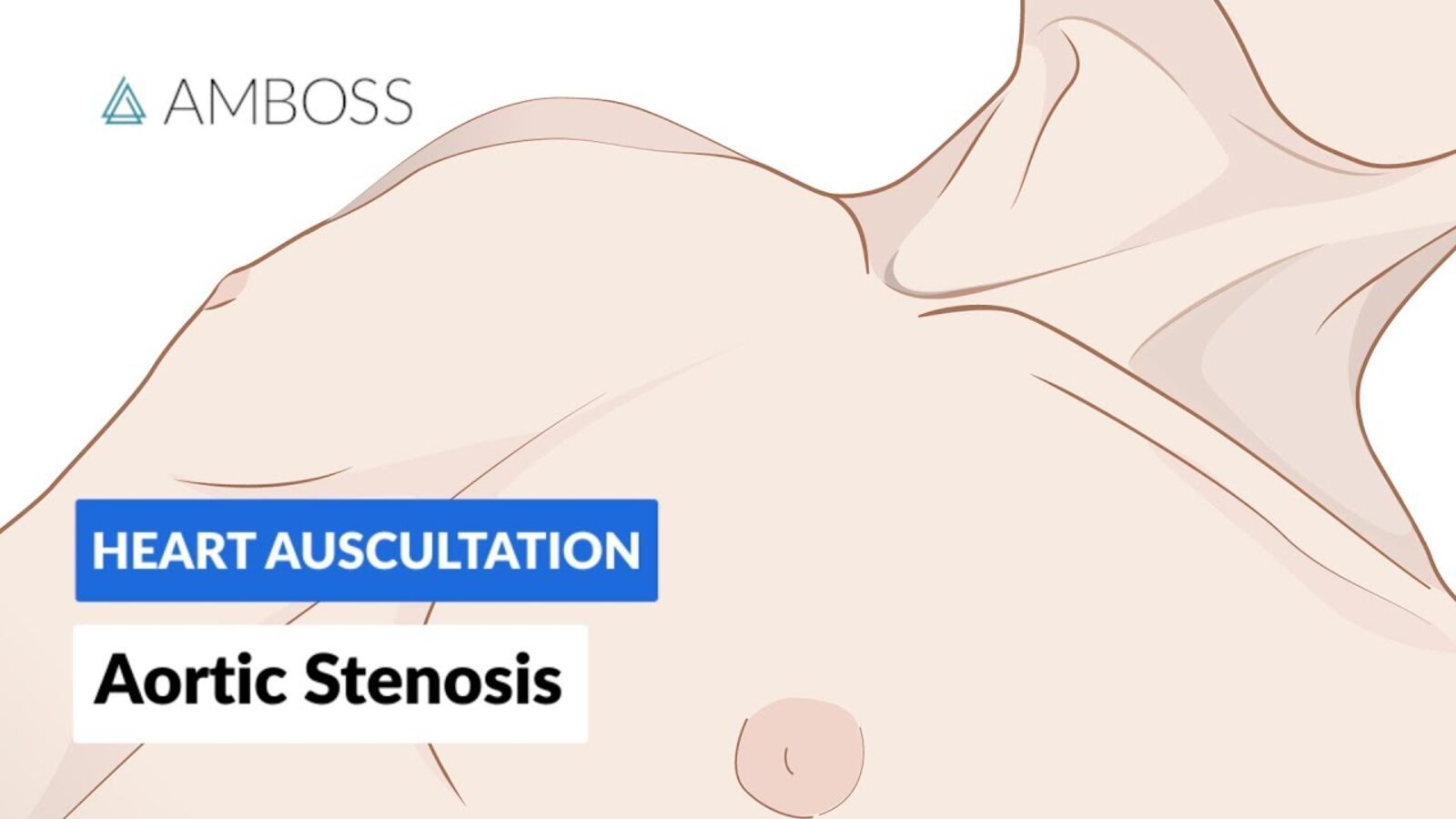 Valvular heart diseases - Knowledge @ AMBOSS
