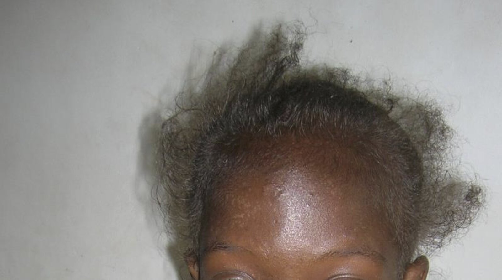 Discover 145+ curving nails hiv latest songngunhatanh.edu.vn