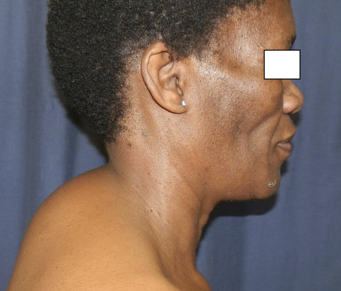 Discover 151+ curving nails hiv best noithatsi.vn