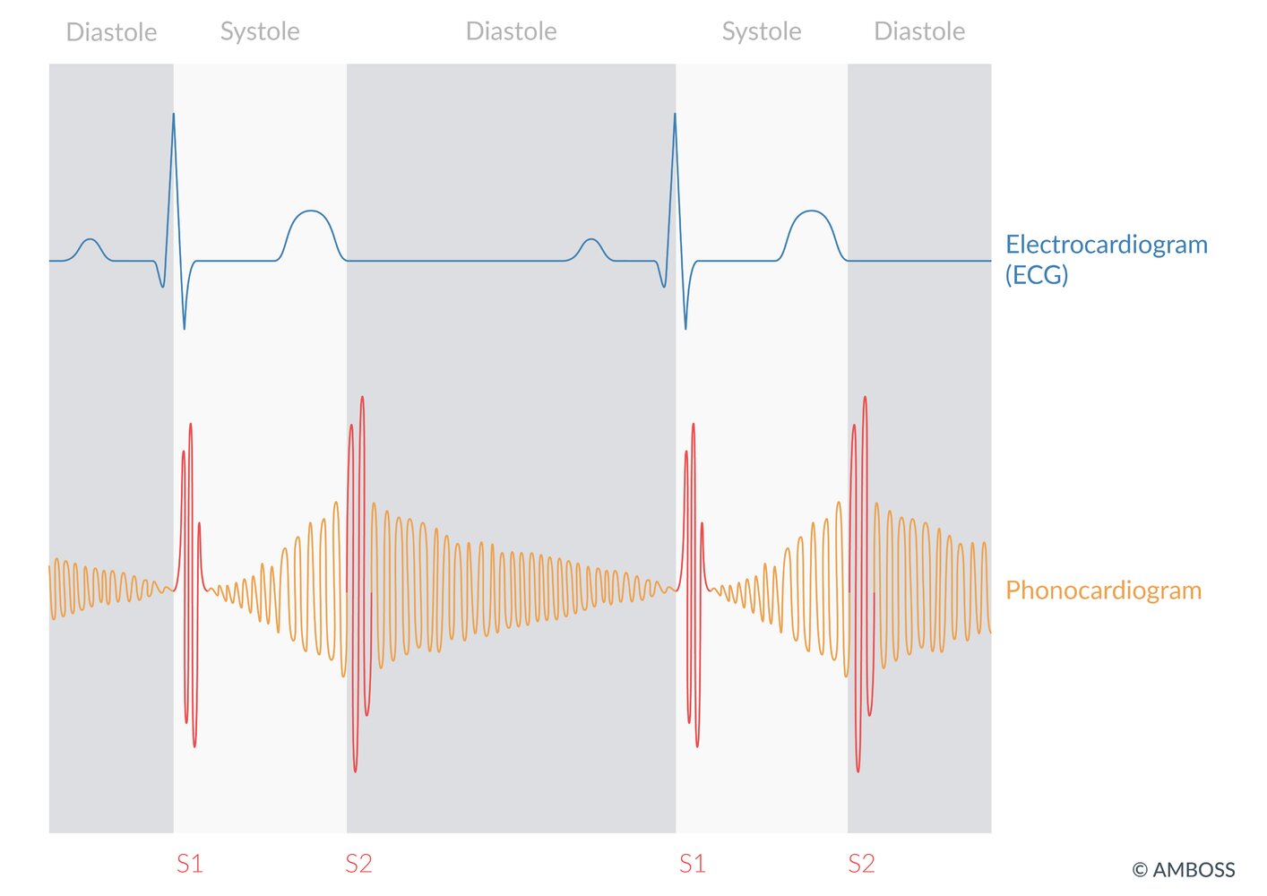cyanosis様 Acyanotic congenital heart defects - Knowledge @ AMBOSS