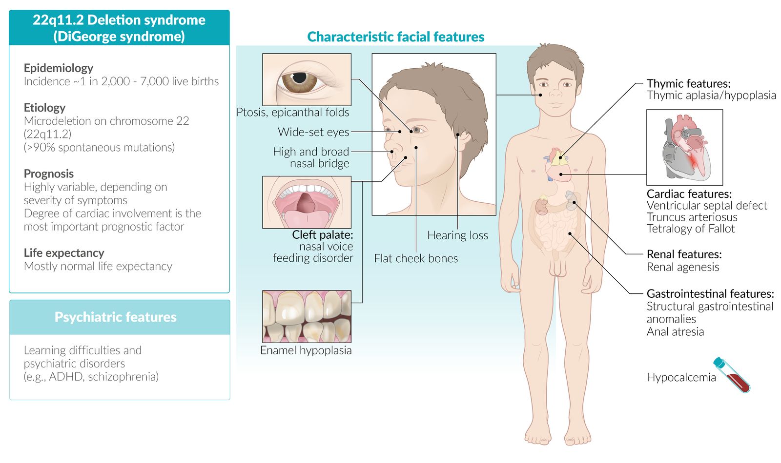 Digeorge Syndrome Features