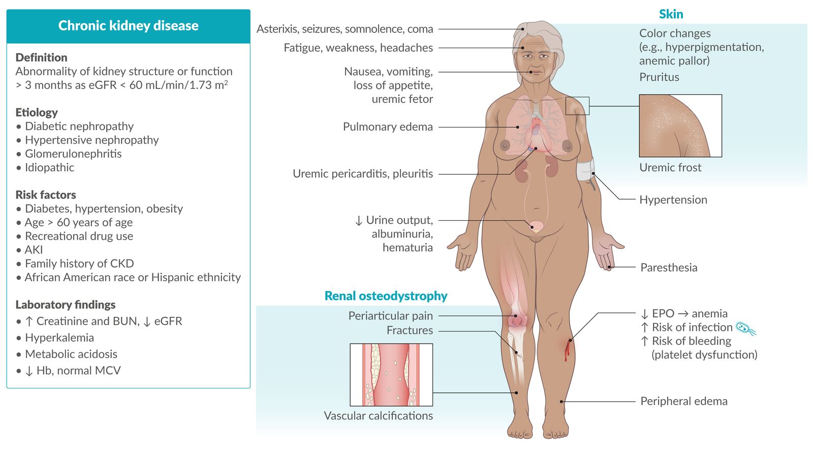 Frontiers | Global, regional, and national burden inequality of chronic  kidney disease, 1990–2021: a systematic analysis for the global burden of  disease study 2021, image size:1600x904