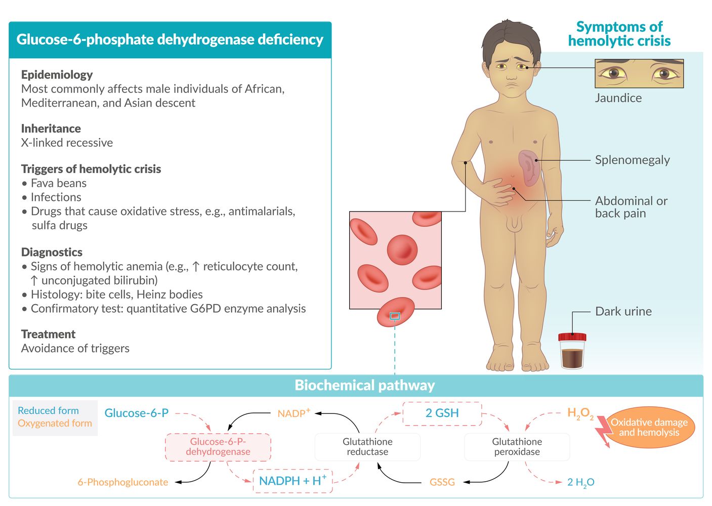 Glucose-6-phosphate dehydrogenase deficiency