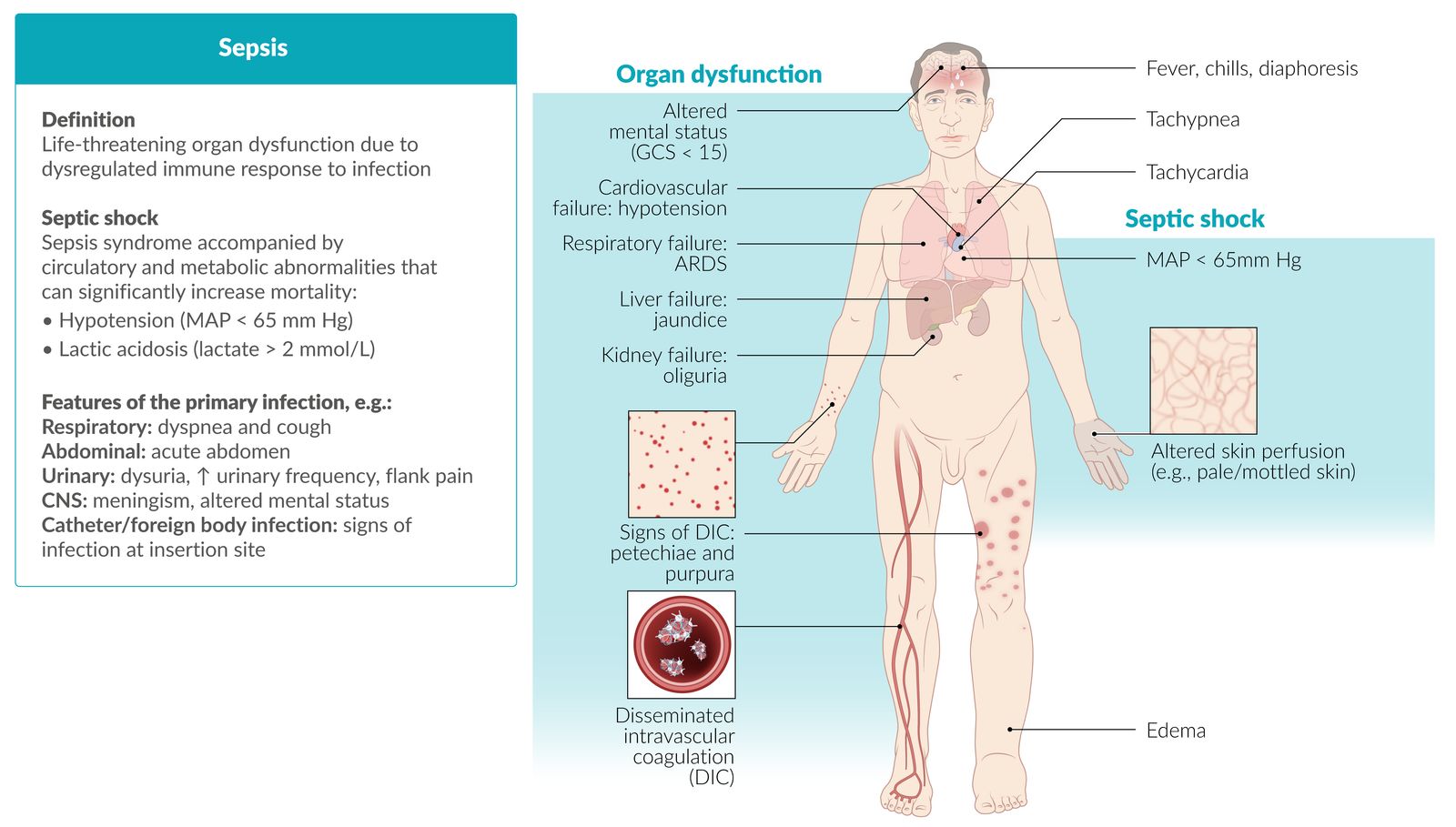 Causes Of Red Flag Sepsis