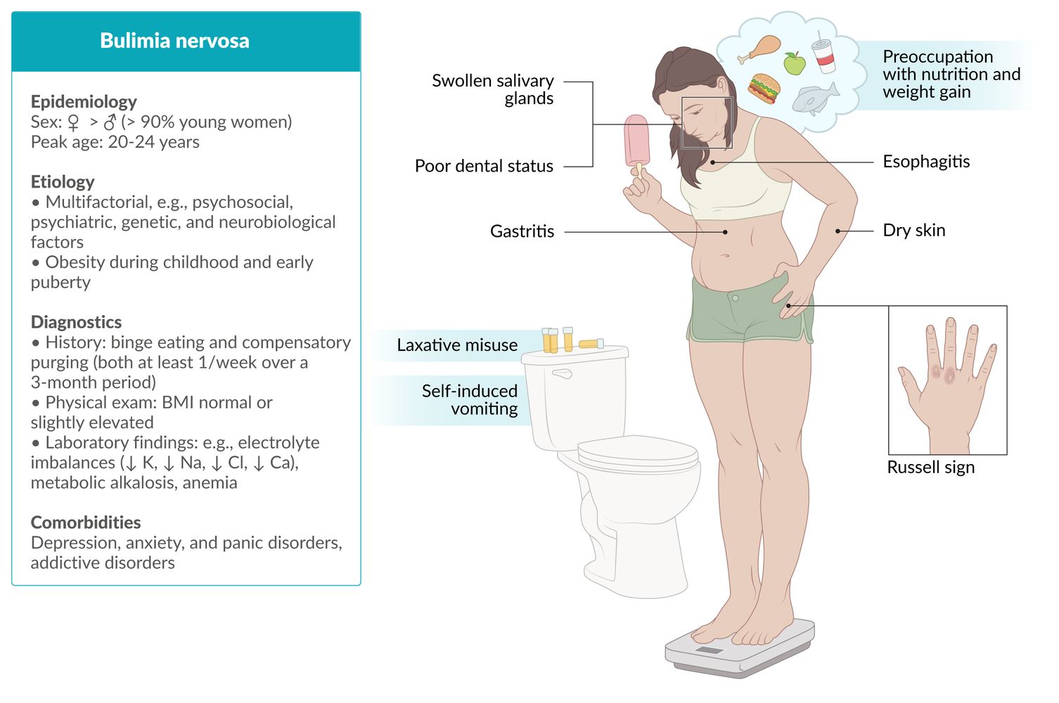 Bulimia Nervosa Plab 2