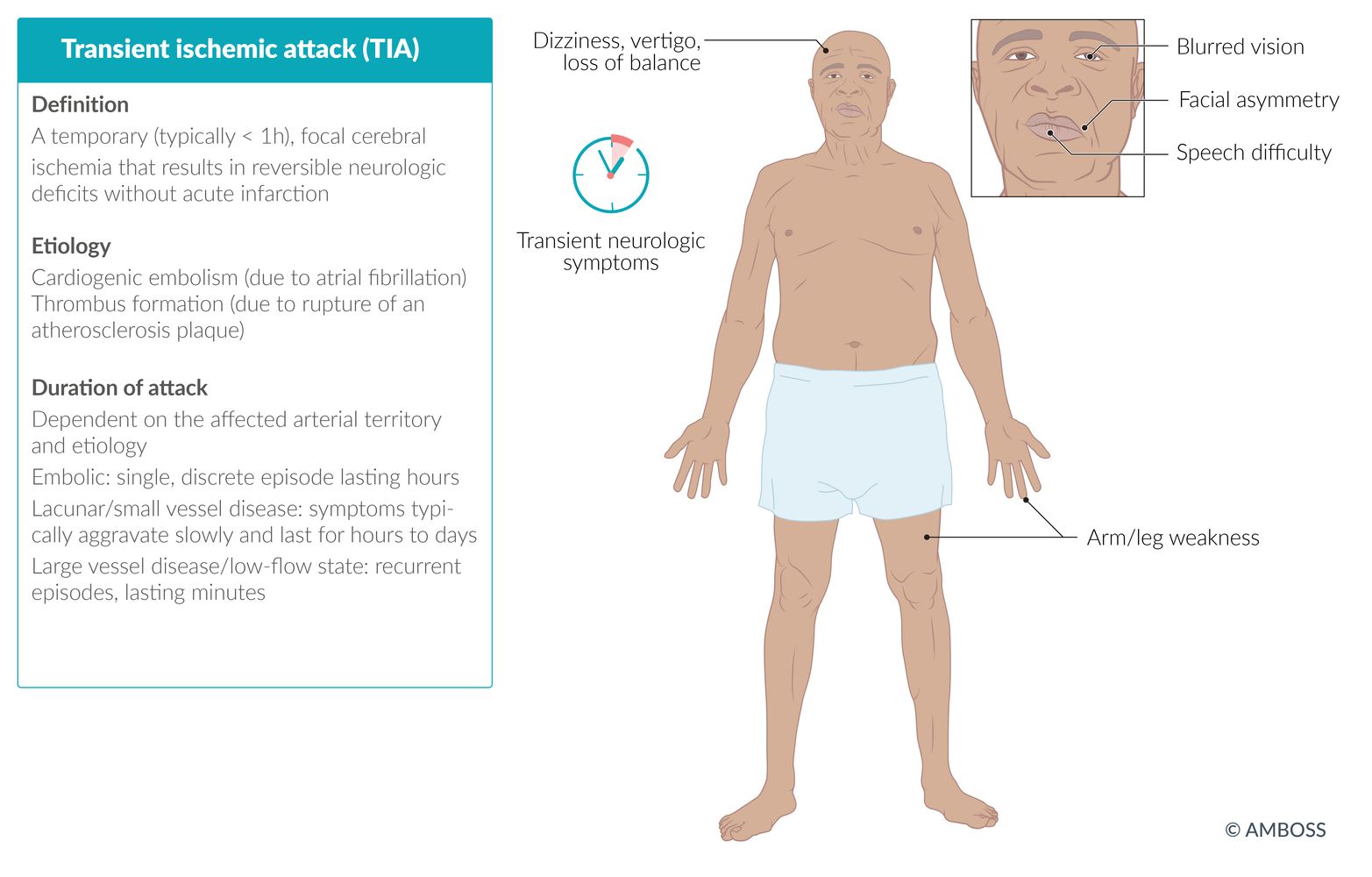 Transient Ischemic Attack Pathophysiology Wikidoc
