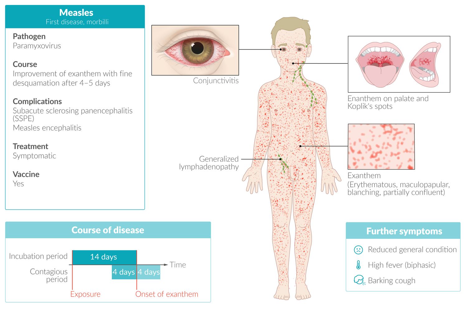 Viral Exanthem Rash Table