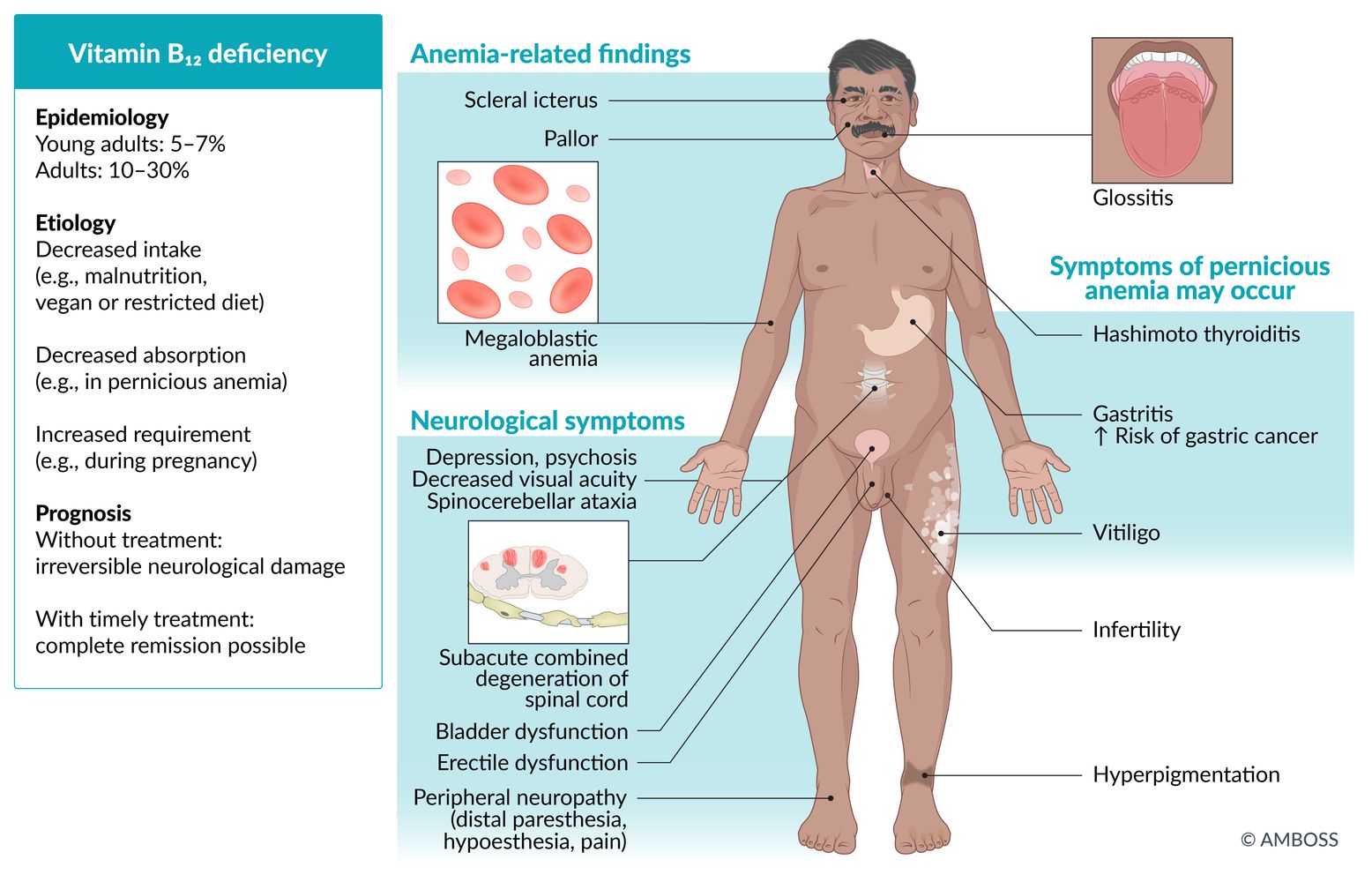 how to give a b12 injection in the thigh Vitamin B12 deficiency