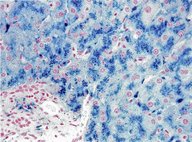 For other staining methods , see: “ Gram staining ” and ” India ink ...
