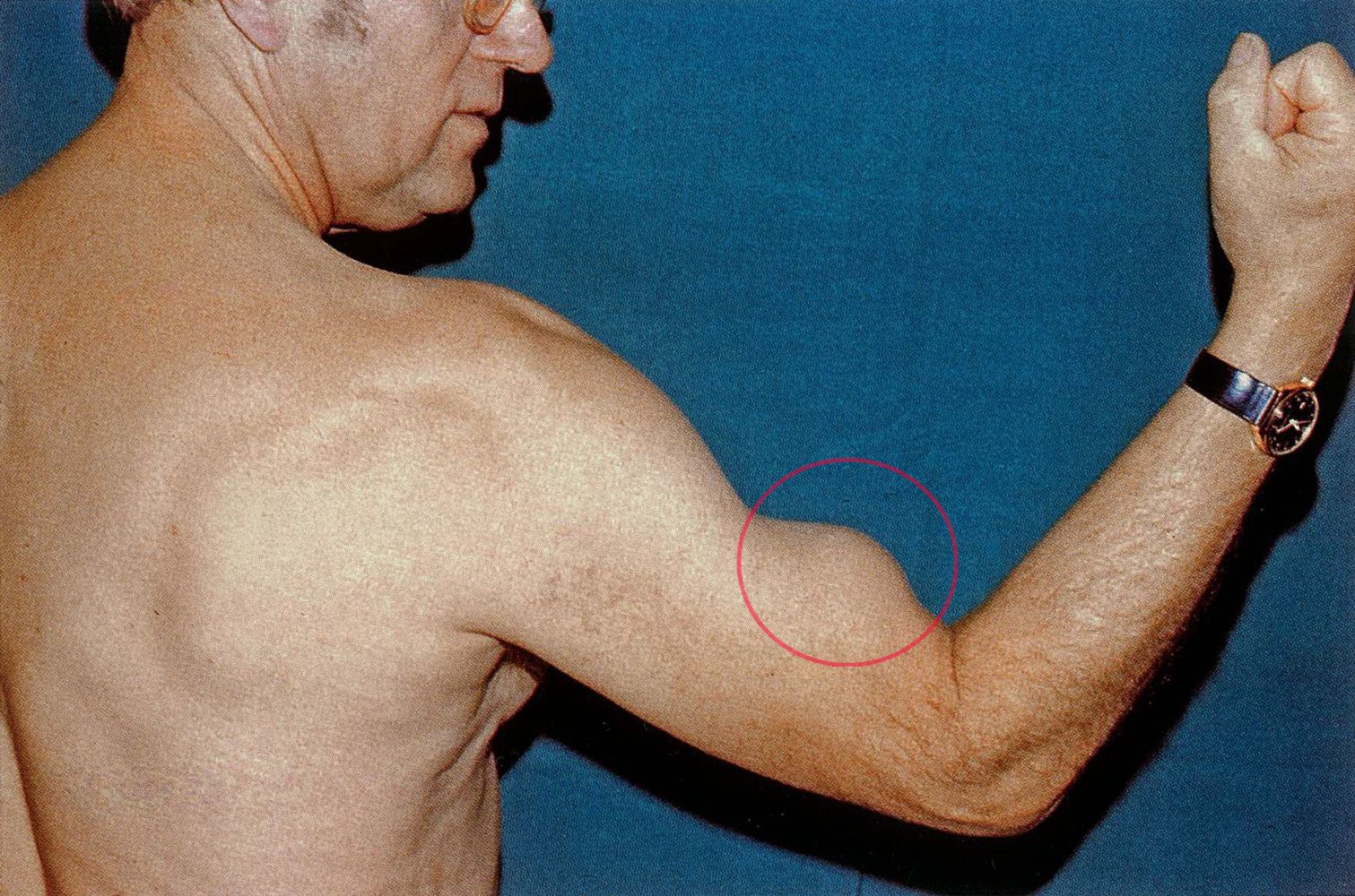 bpc 157 benefits bodybuilding Exercises For Biceps Tendonitis Treatment