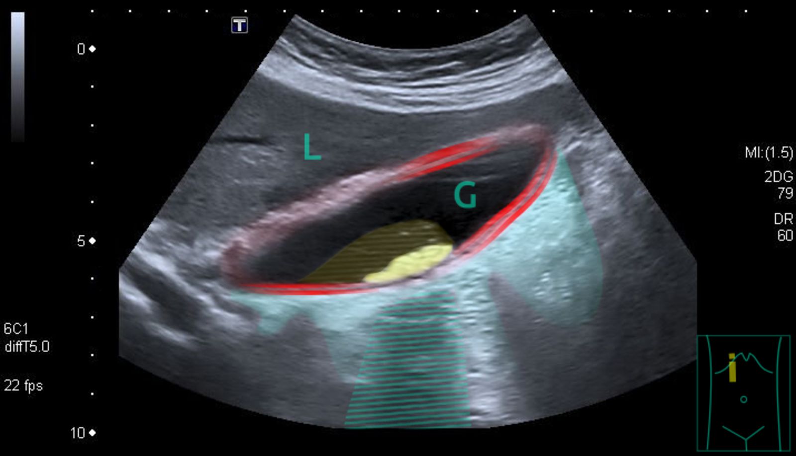 Case 1 Abdominal Pain Knowledge Amboss